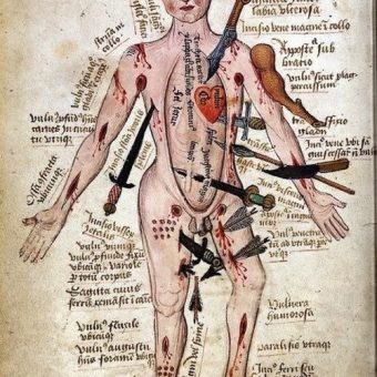 1492: Wound Man Was The Luckiest Man Alive In The Middle Ages