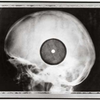 Rib and Bones: When Soviet X-rays became bootleg records of forbidden Western music