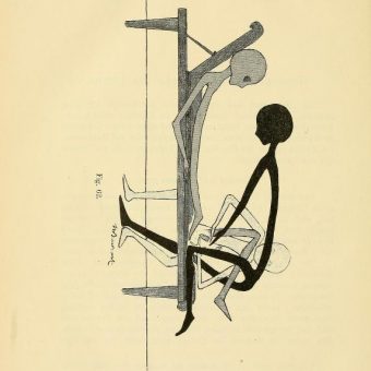 Gynaecology For Women And Other Aliens: Thure Brandt’s Digital Gymnastics (1895)